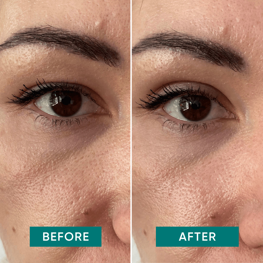 Apricot Eyelid Lifting Tapes – diskrete strips, der giver øjenlåget en øjeblikkelig løftende effekt for et friskere og mere åbent blik