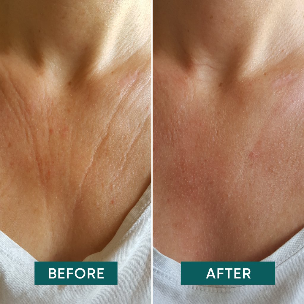 Apricot C-vitamin Décolleté Pad – en genanvendelig maske, der giver huden glød, udglatter linjer og plejer décolleté området