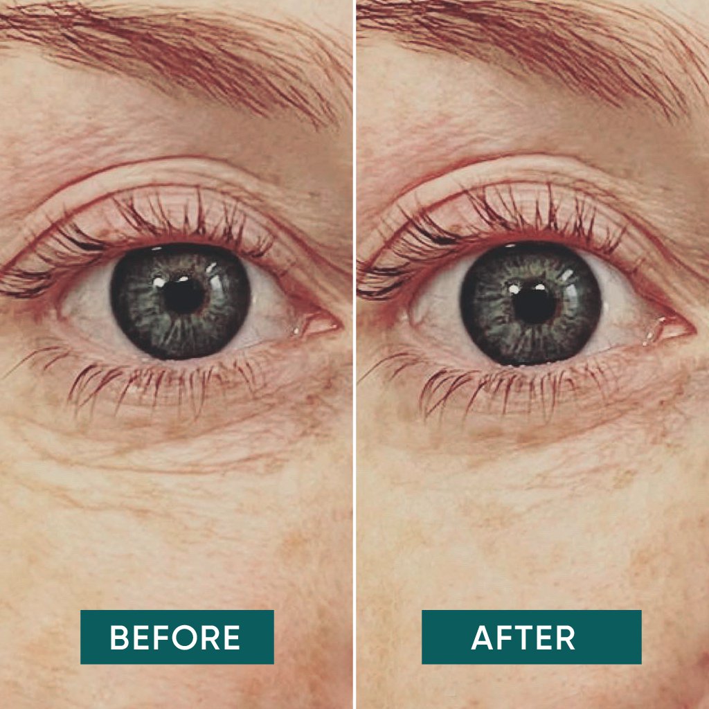 Apricot C-vitamin Eye Pads – genanvendelig øjenmaske, der lysner huden, reducerer mørke rande og udglatter fine linjer