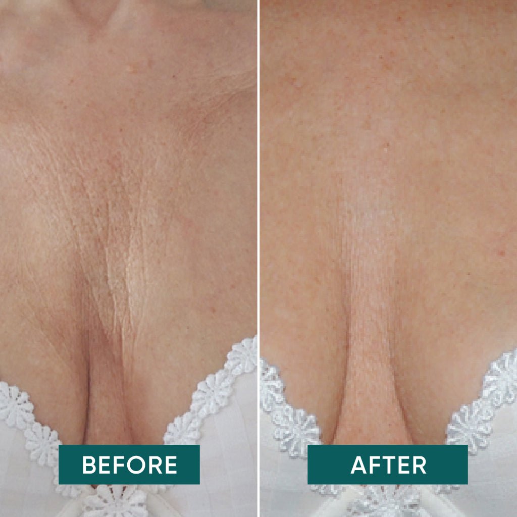 Apricot Ectoin Décolleté Pad – en genanvendelig maske, der fugter, beskytter og reducerer linjer på décolleté området