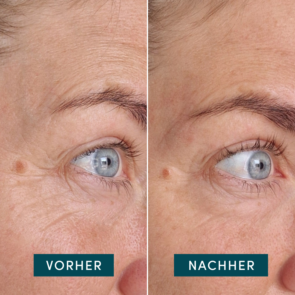 Apricot - Øjenmaske med ectoin | Genanvendelig silikonemaske