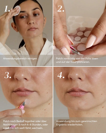 Apricot Post Pimple Patches – plaster der reducerer inflammation, dæmper rødme og mindsker hyperpigmentering – dit hemmelige våben mod ujævne hudtone