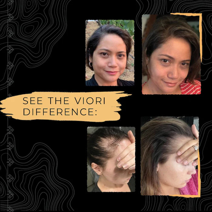 Viori Shampoo &amp; Conditioner Travel Size Sæt – Citrus Yao med Rice Water